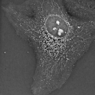 nanolive非侵入式非标记全息断层3D活细胞显微镜