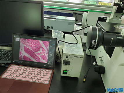 明美显微镜相机助力深圳某YL科技生物试剂检测.png