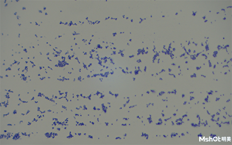 荧光显微镜在细菌筛查中的应用