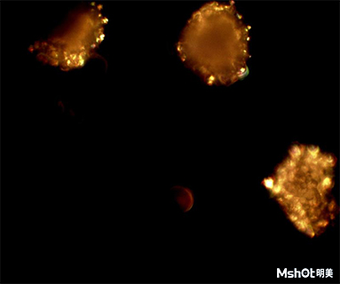 头孢克肟晶体在偏光显微镜下的特征