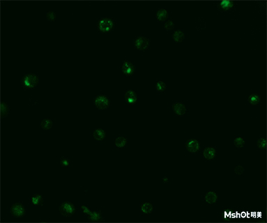 明美倒置荧光显微镜助力中国科学技术大学溶酶体观察