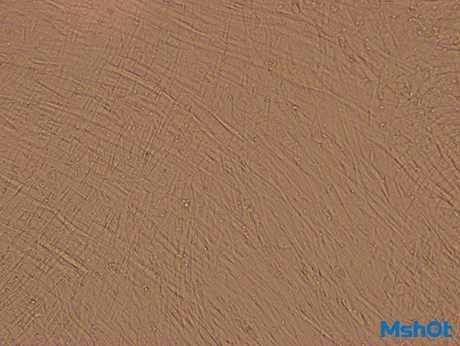 明美倒置显微镜MI52-CF搭配显微镜相机MSX2观察贴壁细胞的生长情况.png