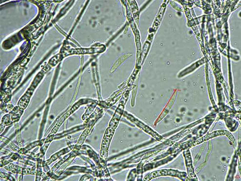 显微镜下的霉菌.jpg