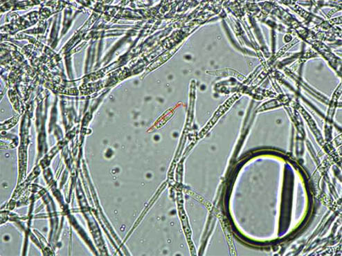 显微镜下的霉菌2.jpg