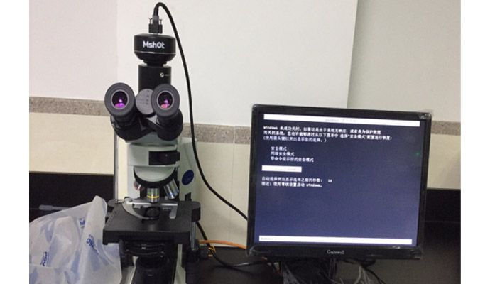 明美显微镜相机应用于恶性肿瘤的诊断与鉴别