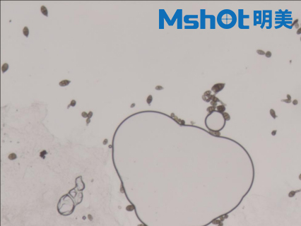 显微镜下真菌孢子