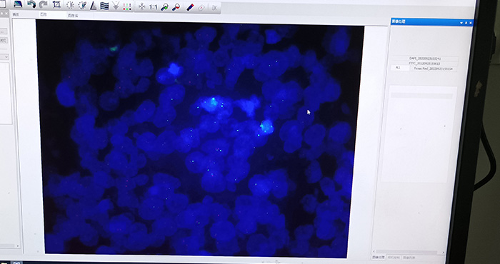 明美原位杂交FISH荧光显微镜系统应用于临床诊断