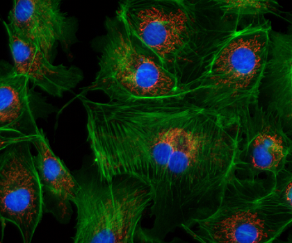 Fluorescence_BPAE-cells_Axiocam-305-color_large.png