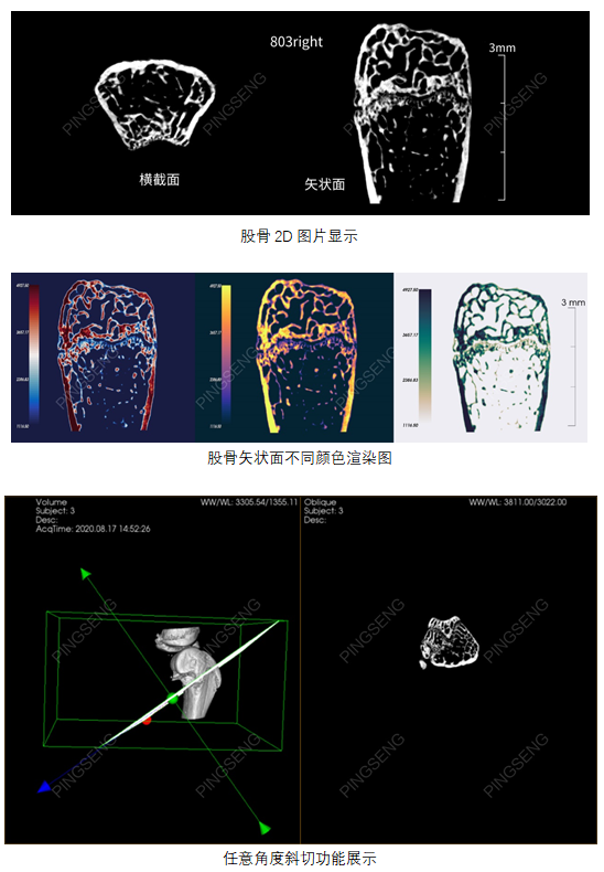 在Micro CT应用中的常规骨分析内容