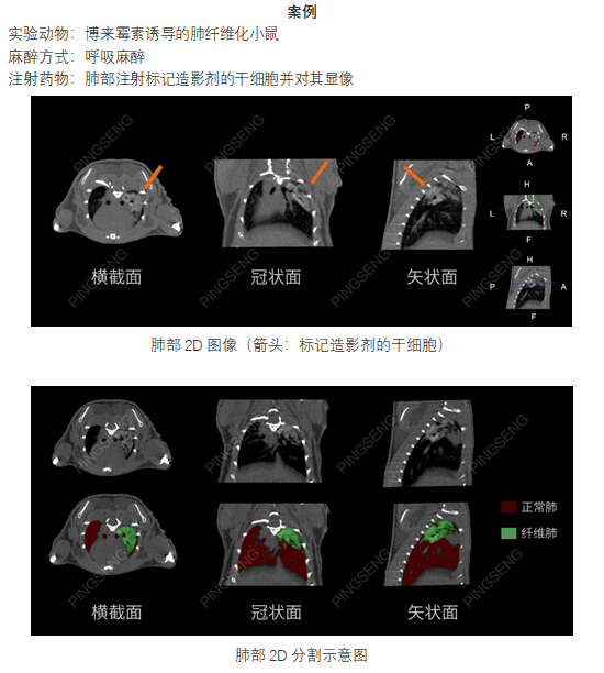 显微CT在活体动物肺纤维化中的应用