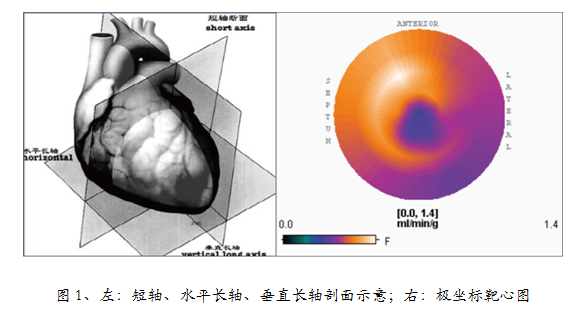 Micro PET结合PMOD在心脏定量中的分析应用