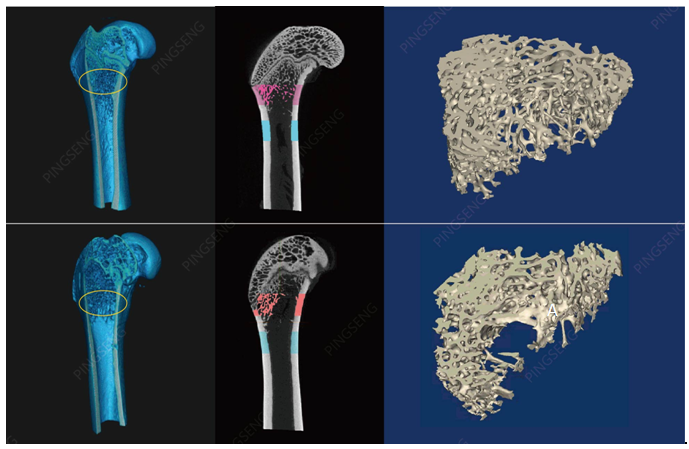 小动物CT的骨分析解析