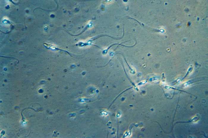 光学显微镜下精子该如何检测？
