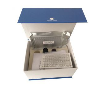 人生長抑素試劑盒,人(SS)ELISA檢測試劑盒