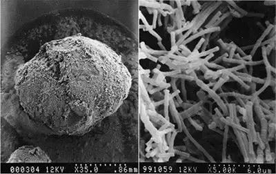 电镜下的颗粒污泥和产甲烷丝菌.jpg