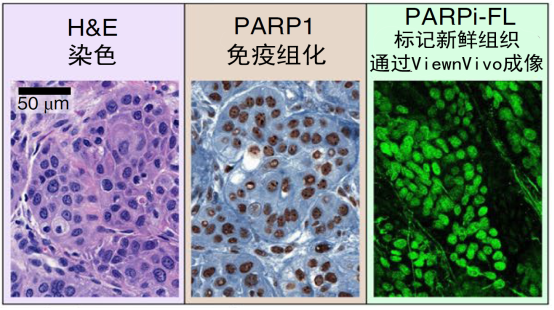 图1. PARPi-FL应用于新鲜组织的共聚焦显微成像具有与组织切片同样的清晰度.png