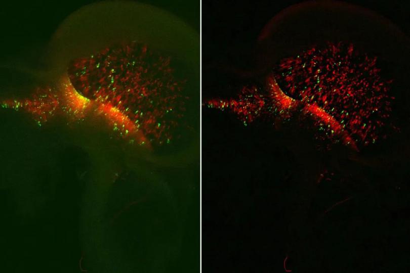 破译发育生物学中的信号通路 | 胚胎神经元祖细胞高<em>对比度</em>成像