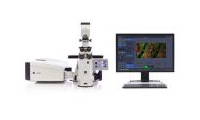 广东省智能科学与技术研究院单光子共聚焦显微镜中标公告