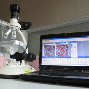 显微细胞成像系统BD-2000