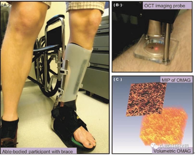 基于OMAG评估下肢缺失患者残肢皮肤反应性充血的方法