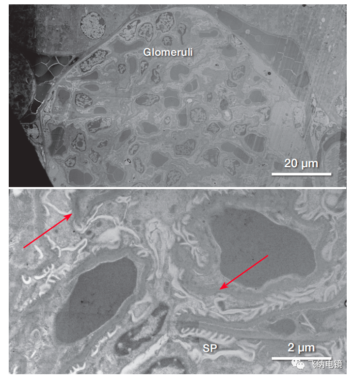 小鼠肾标本样品（肾小球和临近的肾血管）的 STEM 图