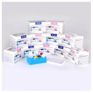 单纯疱疹病毒2型IgM抗体检测试剂盒（酶联免疫法）