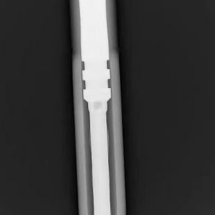 平板探测器耐张线夹X光机便携式X光机
