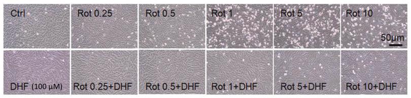 DHF改善线粒体功能缓解Rot诱导的心肌细胞毒性研究