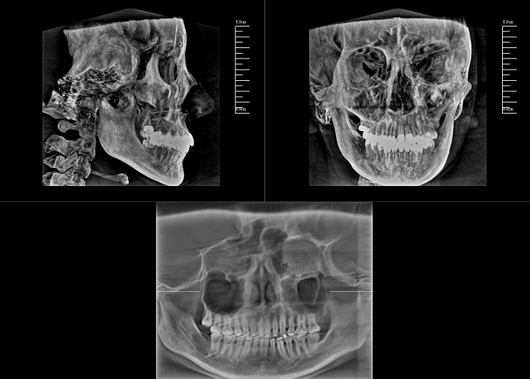 数字化口腔CBCT影像