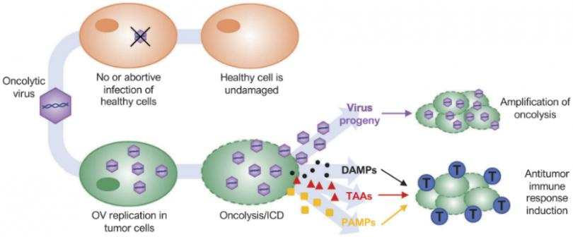 文献速递│荷载溶瘤病毒干细胞在急性髓系白血病中的应用研究