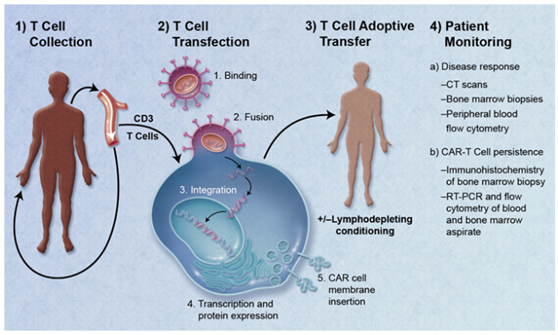 如何为每个患者打造CAR-T细胞产品？