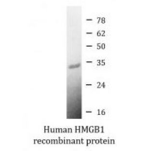 Human HMGB1 recombinant protein (Active) (His-tagg