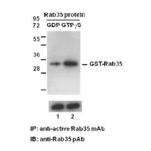 Anti-Rab35-GTP Monoclonal Antibody/费斯德active Rab35