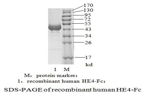 人附睾分泌蛋白（HE4） 电泳图2.jpg