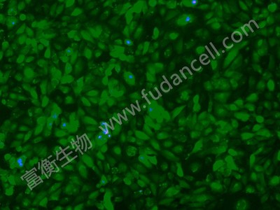 人脐静脉融合细胞带绿色荧光；EAhy926/GFP (STR)