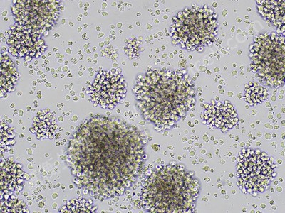 人恶性非霍奇金淋巴瘤患者的自然杀伤细胞；NK-92MI (STR)