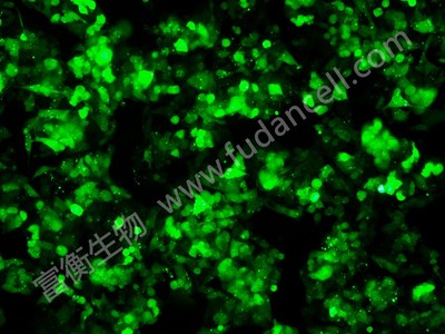 人肝癌细胞带绿色荧光；HepG2/GFP