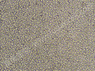 慢性骨髓单核细胞性白血病带荧光素酶； MV-4-11/LUC