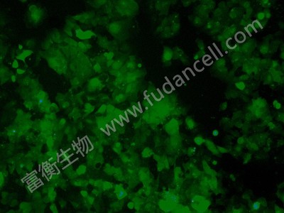 人结肠癌细胞带绿色荧光；HCT-116/GFP (STR)