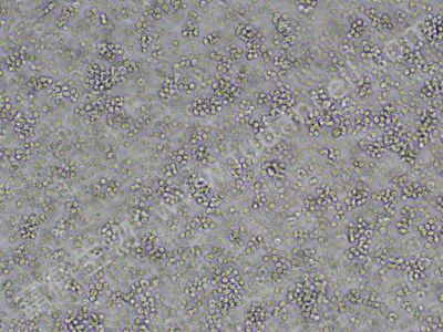 鸡淋巴瘤细胞；DT40