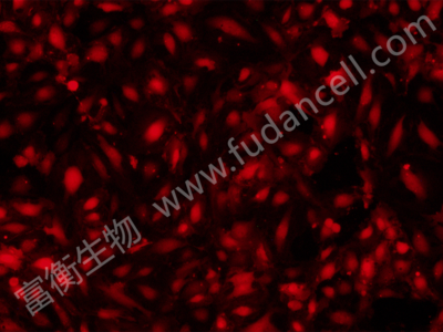 人脐静脉血管内皮细胞带红色荧光；HUVEC/RFP (STR)