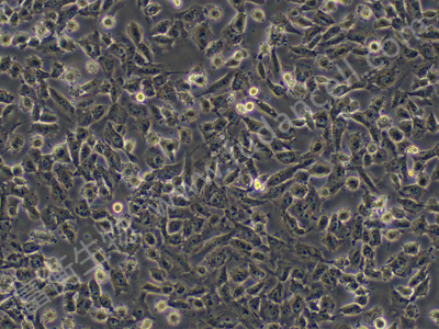 人侵袭性脉络膜黑色素瘤细胞；MUM2B  (STR)