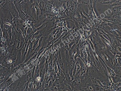 SV40转染人成骨细胞；hFOB1.19 (STR)