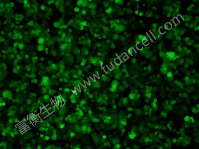 人结肠癌细胞带绿色荧光；HT-29/GFP (STR)