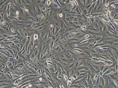 人黑色素瘤细胞；A875 (STR)