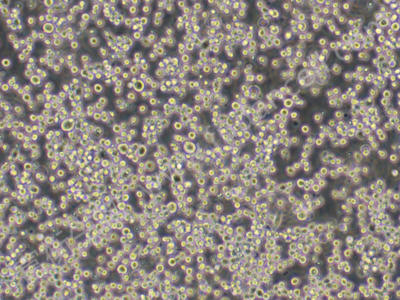 人红白细胞白血病细胞；HEL (STR)