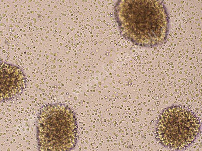 人B淋巴细胞；GM12878 (STR)