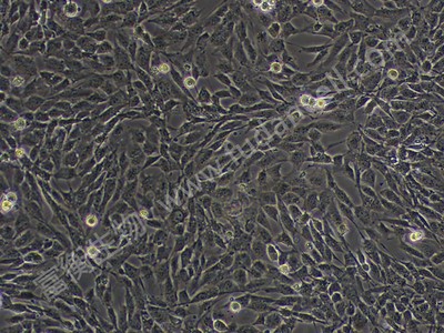 永生化人脑微血管内皮细胞；hCMEC/D3 (STR)