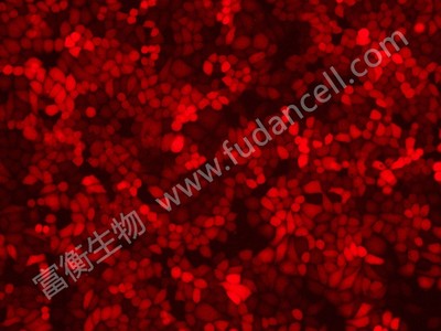 人宫颈癌细胞带红色荧光；HELA/RFP