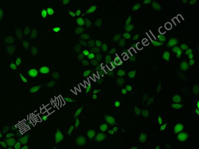 人宫颈癌细胞带绿色荧光；hela/gfp  (STR)